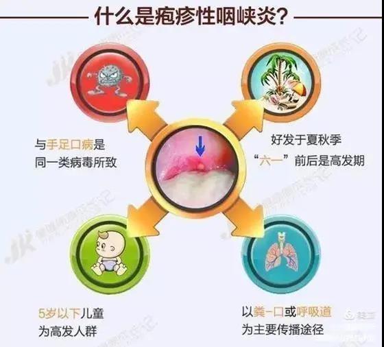 疱疹性咽峡炎及手足口病不用慌，紫外线灯来帮忙